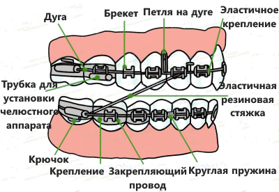 brecket-shema